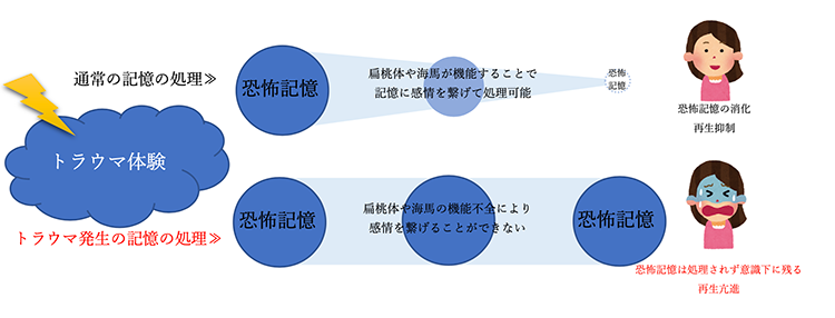 トラウマ記憶